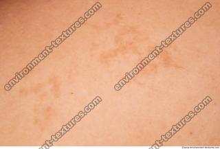 Photo Textures of Human Skin